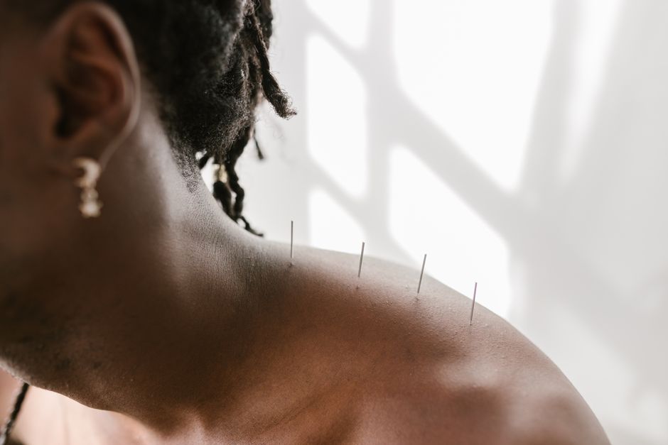 What Does Acupuncture Treat?
