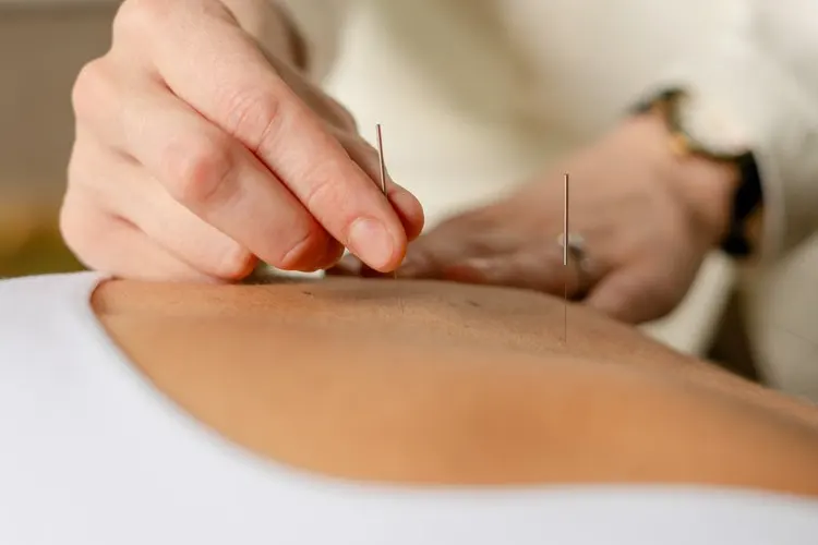 Anti Aging & Aesthetics 5 acupuncture a