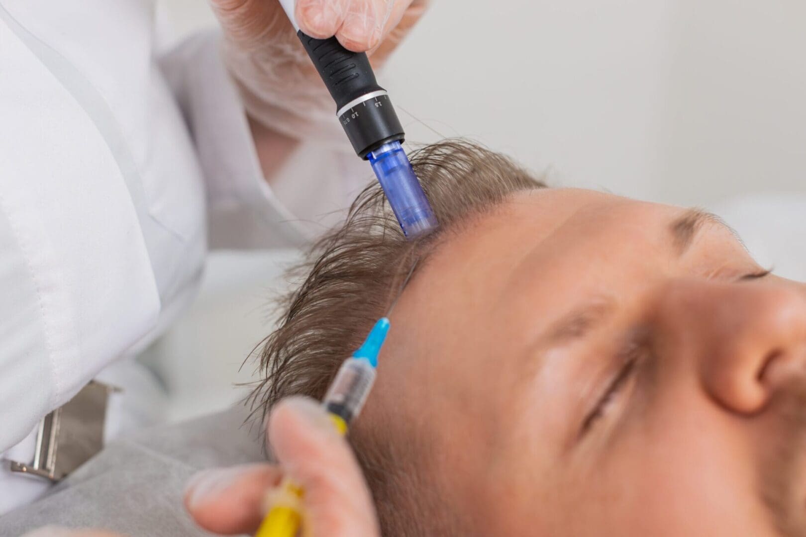 PRP vs Exosome Therapy prp vs exosome therapy